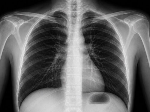 Opis RTG jednej okolicy anatomicznej
